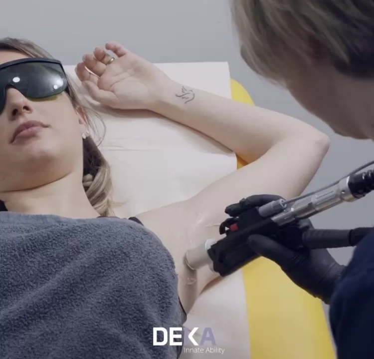 Épilation aisselles au laser à Charbonnières-les-bains