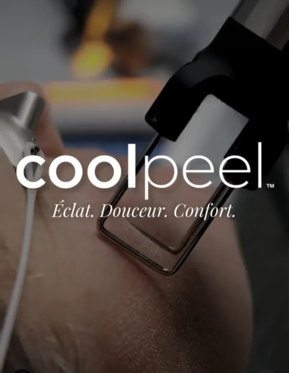 Tarif découverte Coolpeel 120 euros , Charbonnières-les-Bains, Docteur LE GUILLOUZIC Solenne