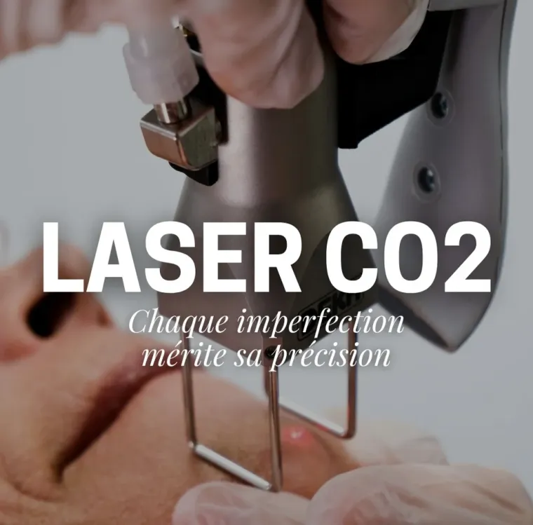 Quelle est la période de l'année la plus appropriée pour faire du laser CO2 ?, Charbonnières-les-Bains, Docteur LE GUILLOUZIC Solenne