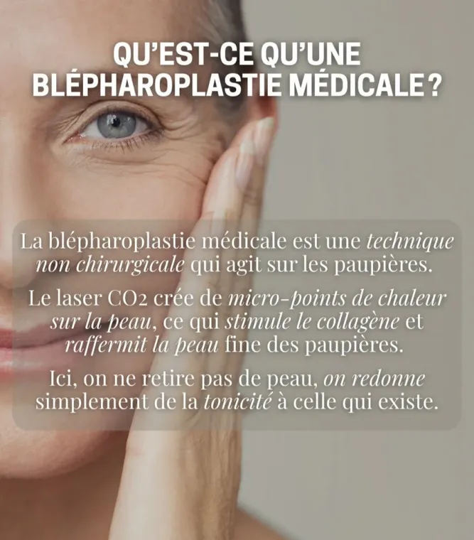 Quel est l'intérêt d'une blepharoplastie médicale au laser CO2 ?, Charbonnières-les-Bains, Docteur LE GUILLOUZIC Solenne