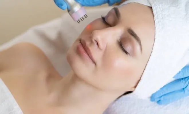 Traitement Coolpeel, Charbonnières-les-Bains, Docteur LE GUILLOUZIC Solenne