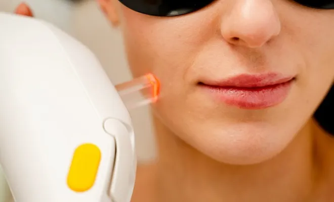 Laser pigmentaire , Charbonnières-les-Bains, Docteur LE GUILLOUZIC Solenne